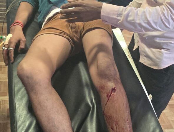 मोतिहारी: सोना-चाँदी व्यवसाई को गोली मारकर लूट, SIT गठित