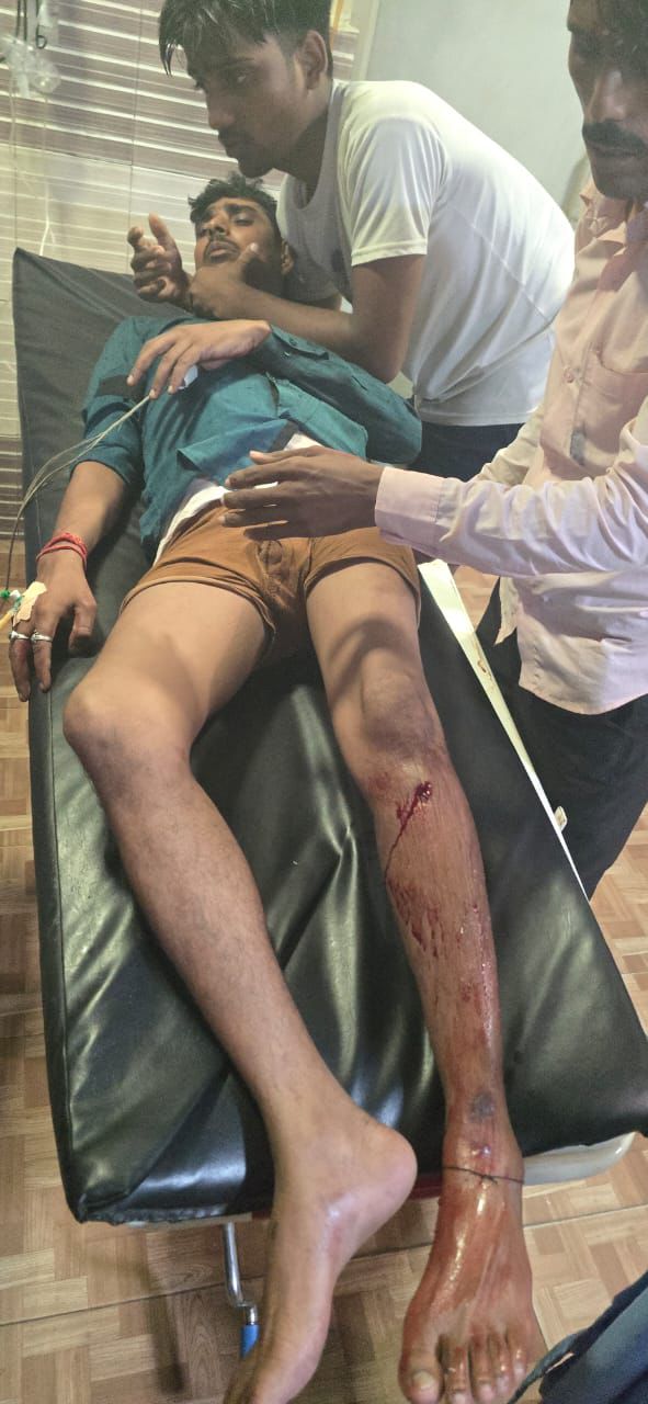 मोतिहारी: सोना-चाँदी व्यवसाई को गोली मारकर लूट, SIT गठित